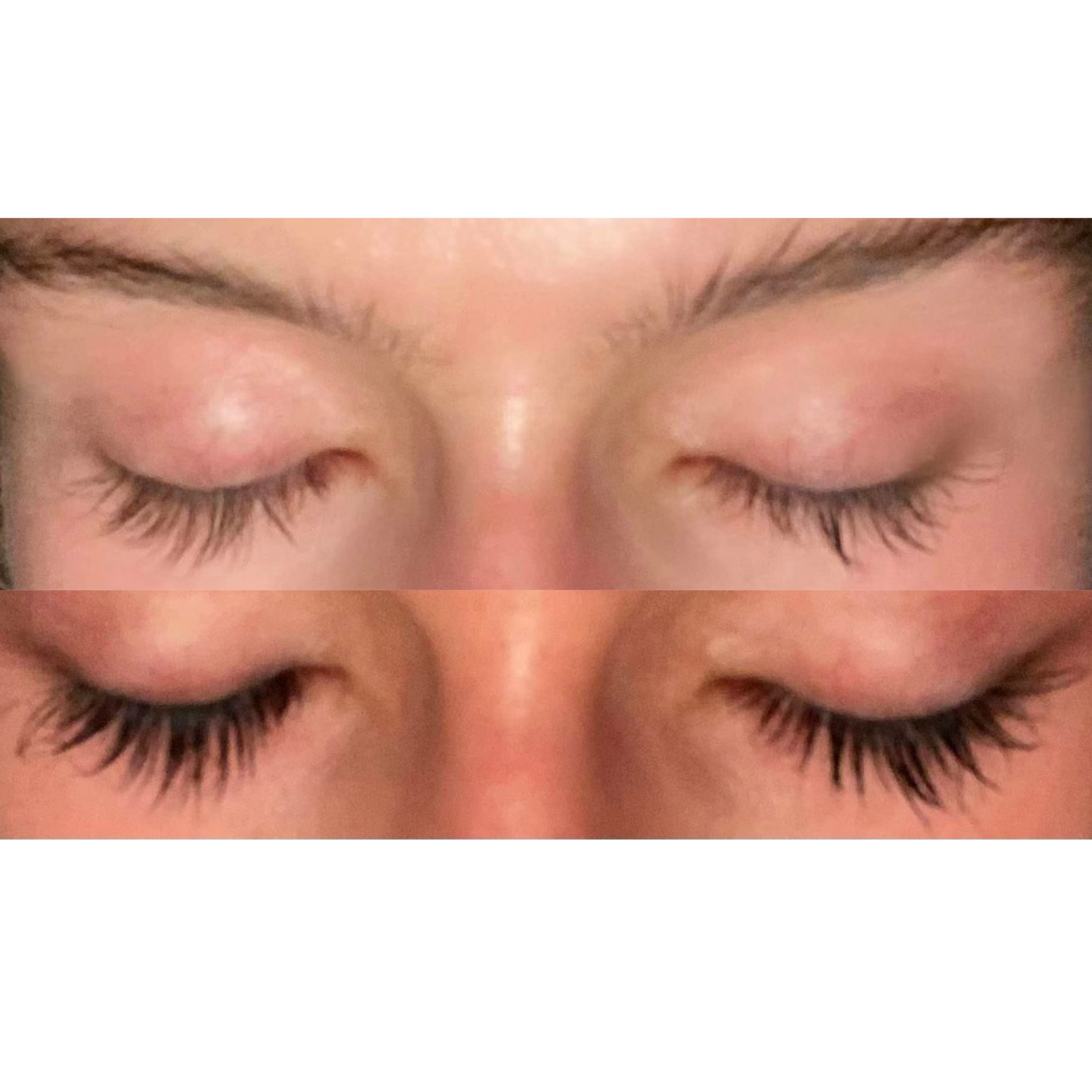 Eyelash Serum